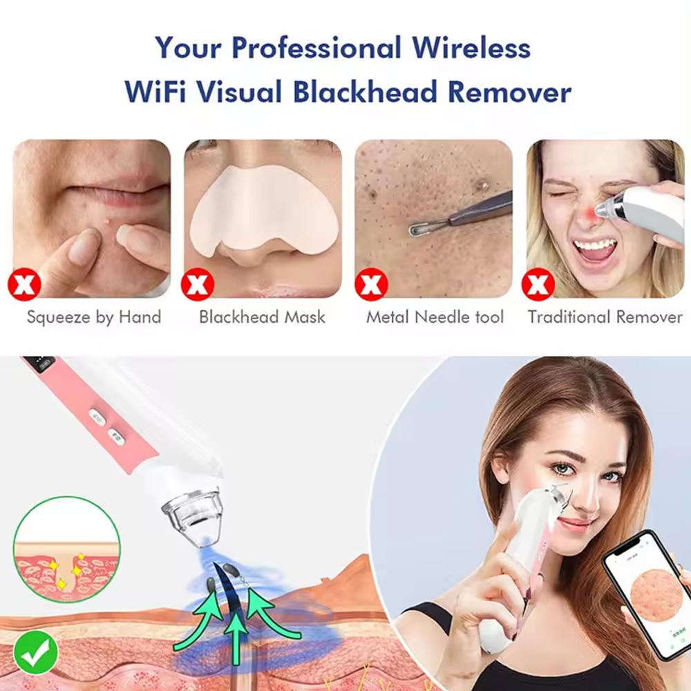 6 Heads Pore Cleaner Blackhead - Pore Vacuum recensione e prezzo