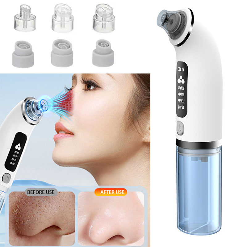 Face Nose Blackhead Remover Po - Pore Vacuum recensione e prezzo