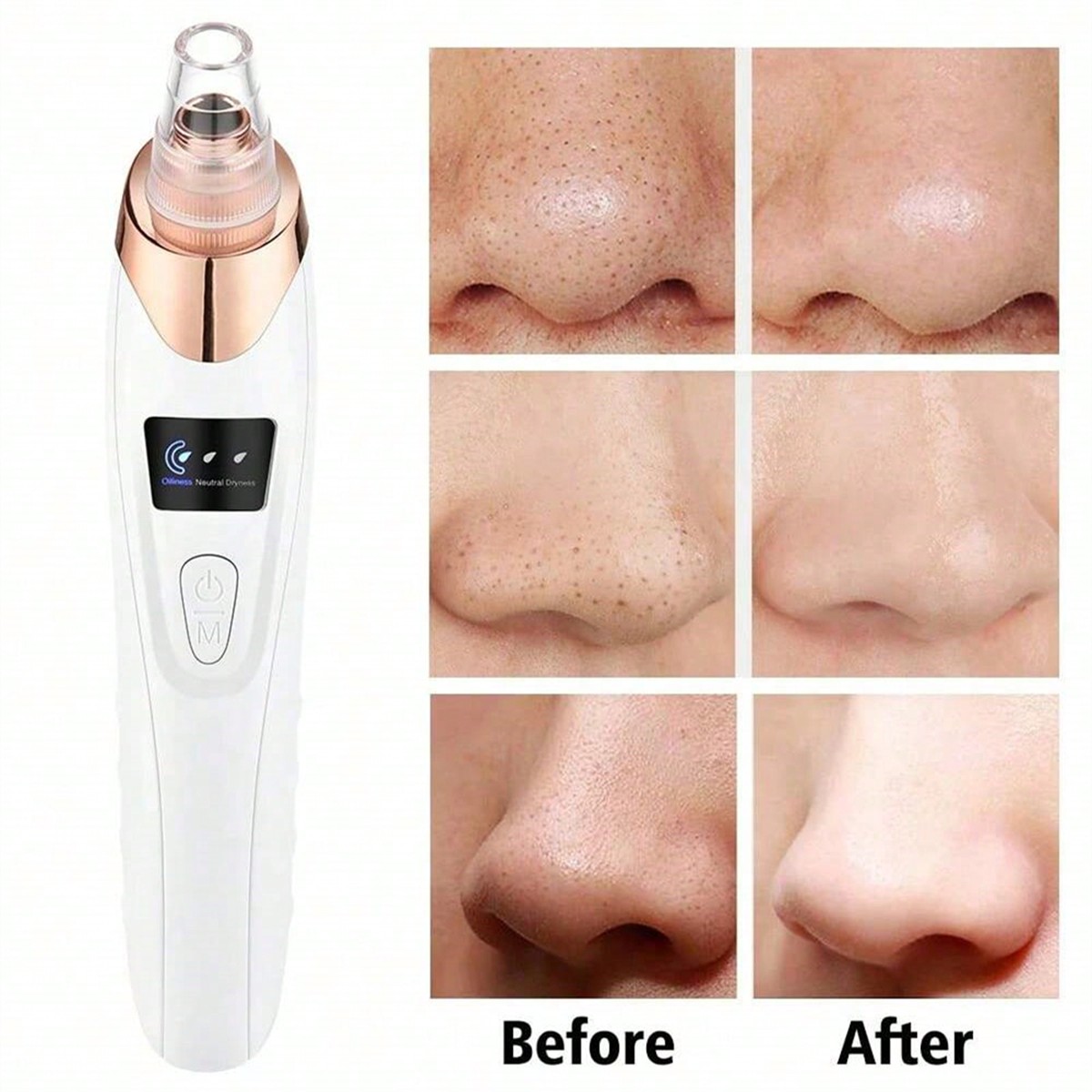 2026 Facial Pore Cleaner, 5 Su - Pore Vacuum recensione e prezzo