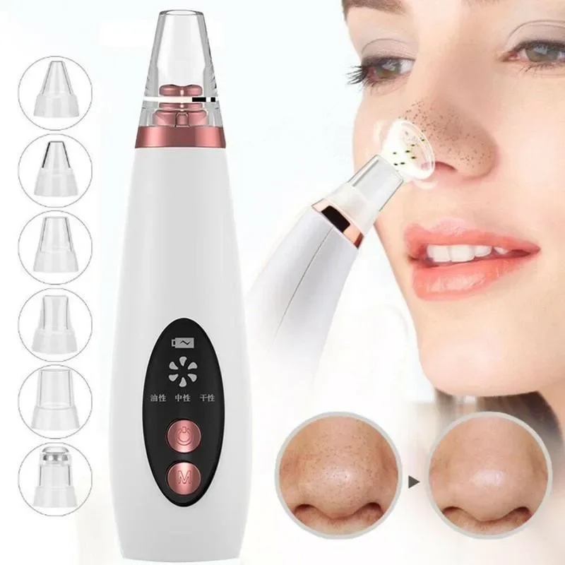 USB Charging Face Pore Vacuum  - Pore Vacuum recensione e prezzo