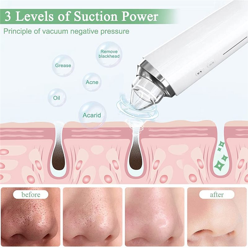 【FITTING】Blackhead Remover Por - Pore Vacuum recensione e prezzo
