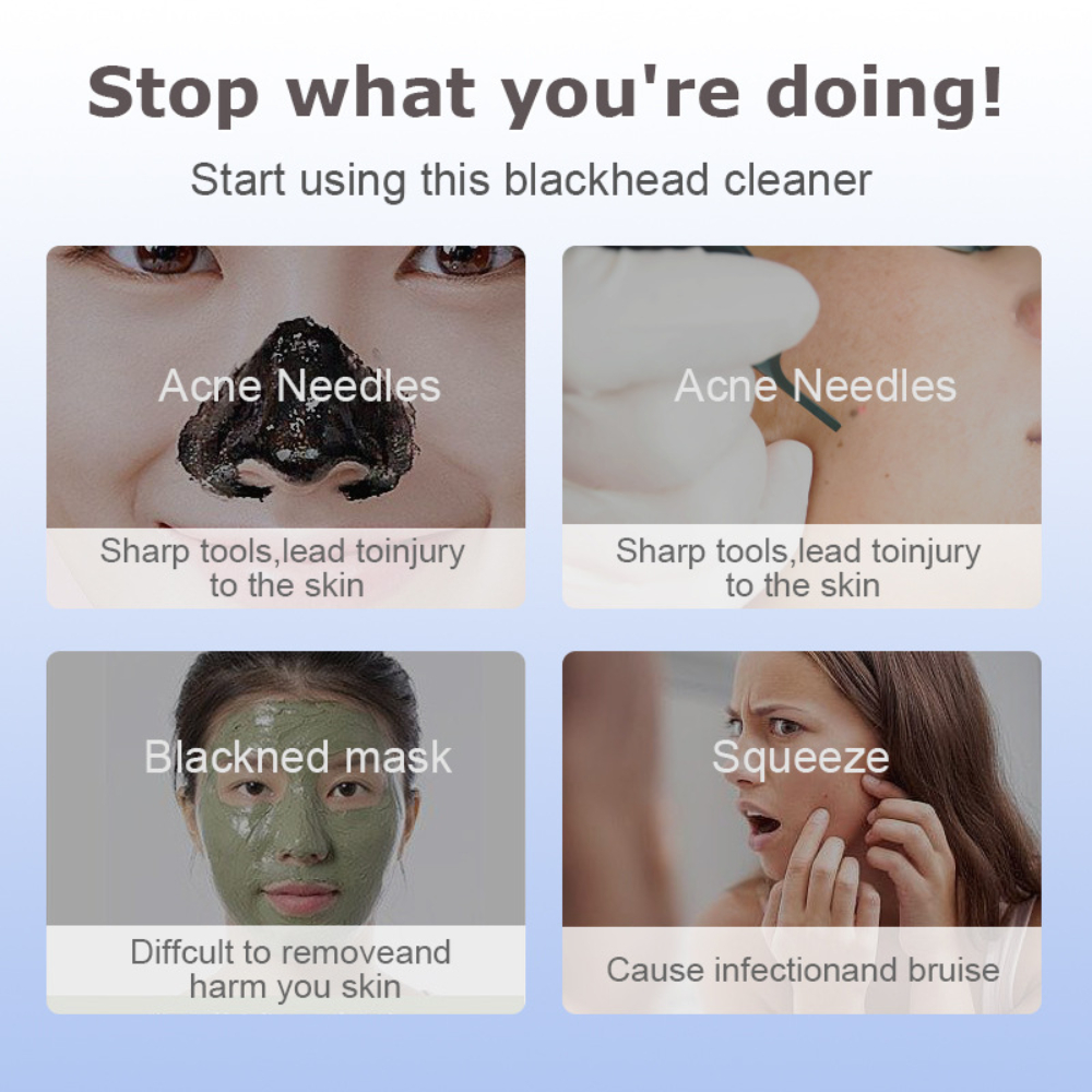 Electric Blackhead Remover 3 S - Pore Vacuum recensione e prezzo