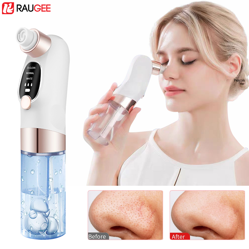 Blackhead Remover Electric Bla - Pore Vacuum recensione e prezzo