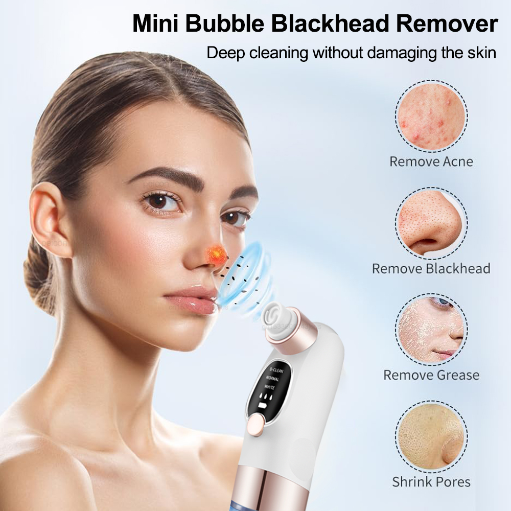 Blackhead Remover Electric Bla - Pore Vacuum recensione e prezzo