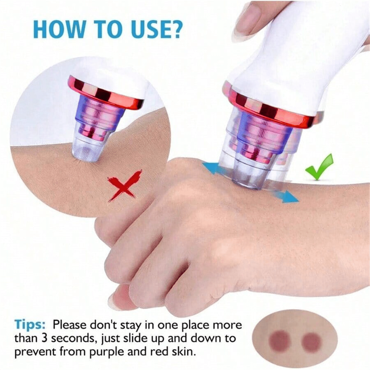 2026 Blackhead Remover Pimple  - Pore Vacuum recensione e prezzo