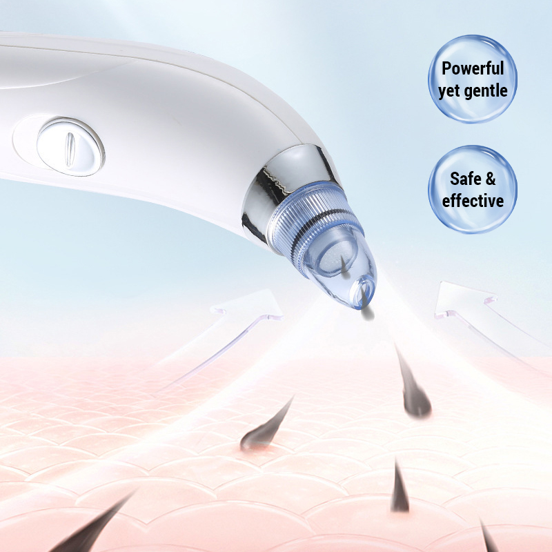 3 IN 1 Suction Blackheads God  - Pore Vacuum recensione e prezzo