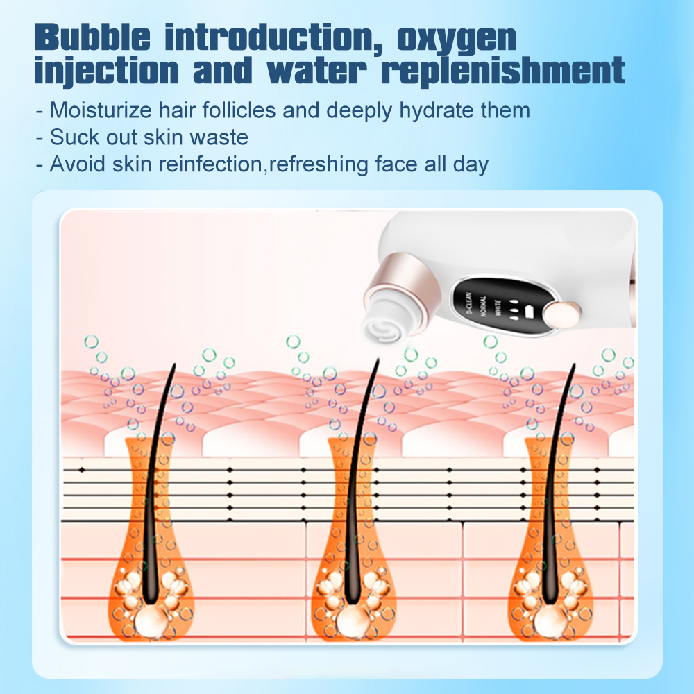 Electric Bubble Blackhead Remo - Pore Vacuum recensione e prezzo