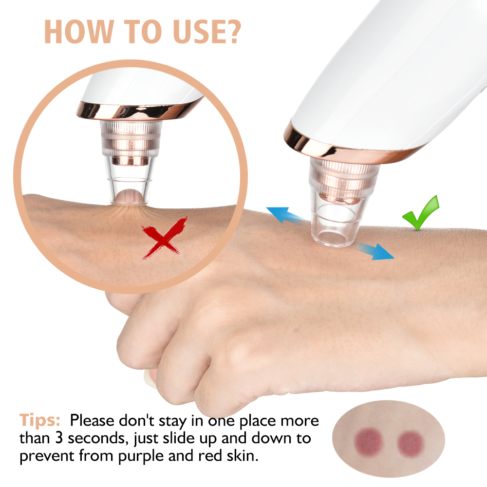 Blackhead Remover Vacuum Pore  - Pore Vacuum recensione e prezzo