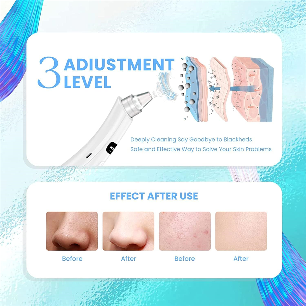 Blackhead Remover Pore Vacuum, - Pore Vacuum recensione e prezzo